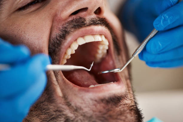 Best Dentist for Tooth Abscess  in Osceola Mills, PA