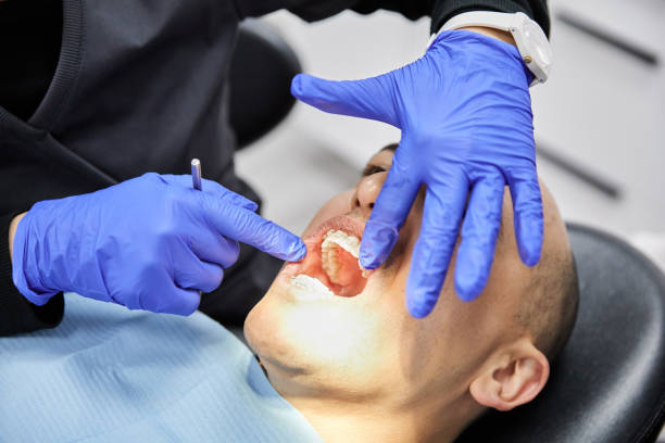 Best Emergency Gum Pain Relief  in Osceola Mills, PA